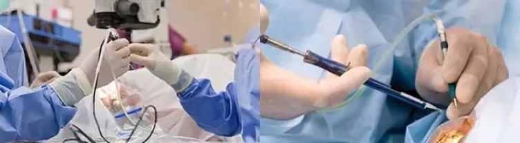 Surgery to restore vision.